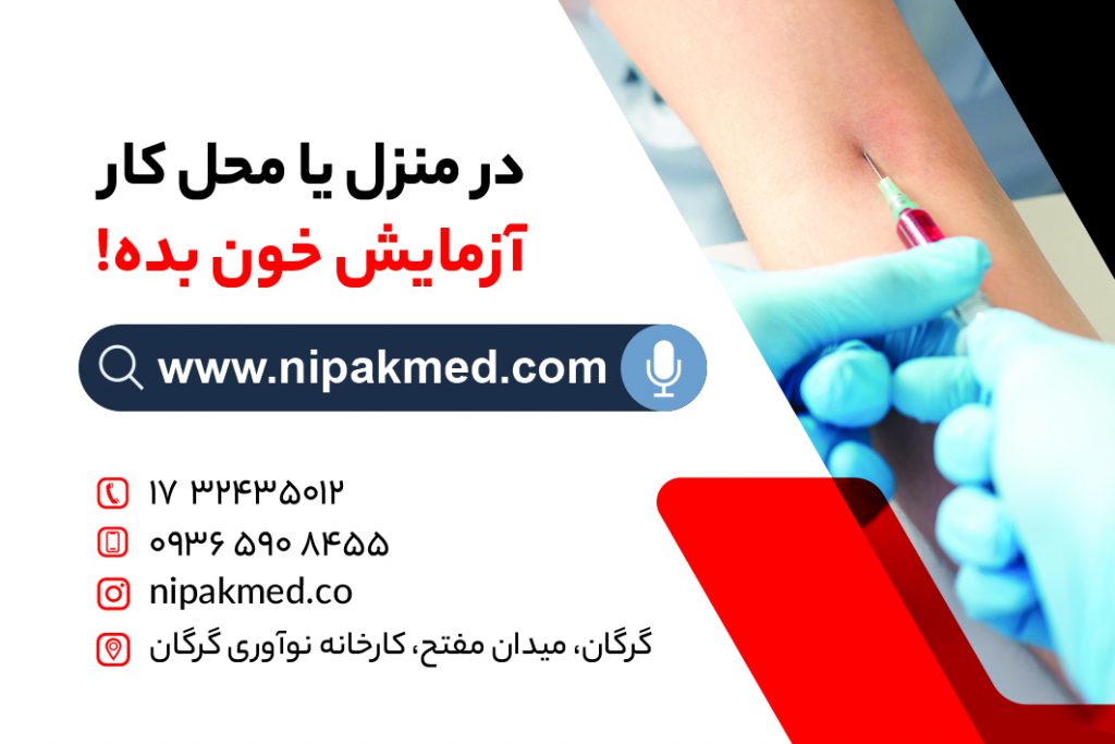 آزمایش در منزل گرگان